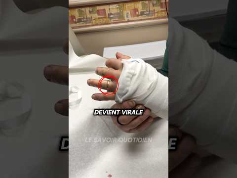 La technique la plus intelligente pour retirer une bague !