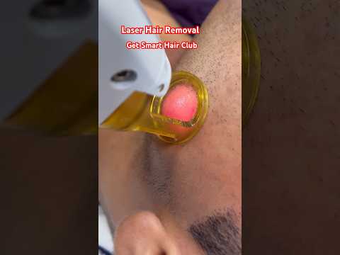 Laser Hair Removal #hair