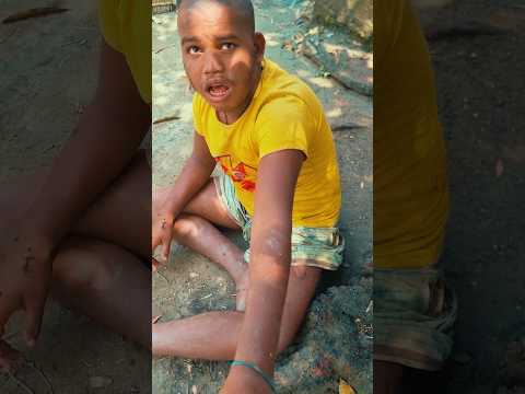 এই ছেলেটার জন্ম থেকেই পাগল বাবার টাকার অভাবে চিকিৎসা করতে পারছে না #comedy #foryou #comedymove