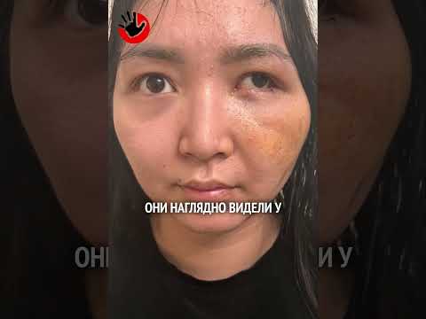 Муж проломил мою голову на глазах у детей. И скоро может выйти по УДО. #НеМолчиKZ