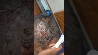 Bugs on the head 😲☹️🥺 #vairalvideo #foryou #surgerytips #bugs #surgeryreview #surgeryeducation