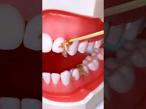 Portable Tooth Cleaning Set #shorts #gadgets #teethcleaning #products