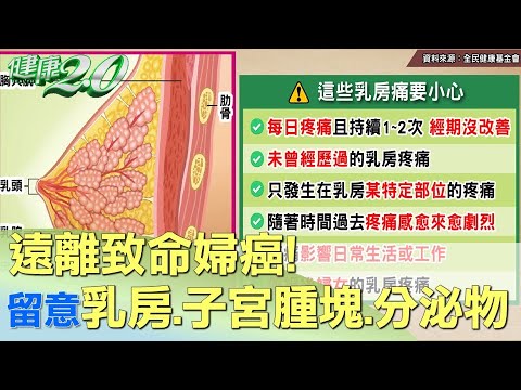 遠離致命婦癌！留意乳房、子宮腫塊、分泌物警訊 健康2.0