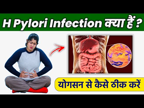 H Pylori Infection Kya Hota Hai ? | Yoga & Exercise for Helicobacter Pylori Ulcer