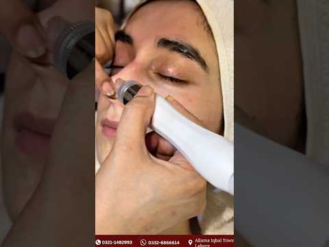 Get Glowing Skin with Our Top-Rated Hydra Facial! ✨💧#makeupbyash #hydrafacial