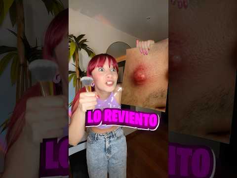Exprimí el GRANO más ASQUEROSO🤢🤮