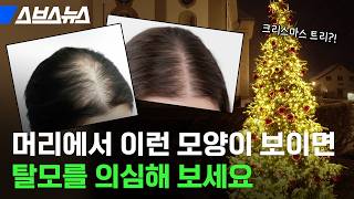 M자 탈모보다 치료하기 어려운 여성 탈모? 탈모 기능성 화장품이 유행하게 된 이유 / 스브스뉴스