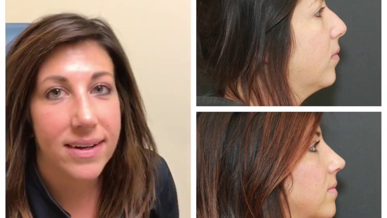 Woman speaking, three images with varying expressions.