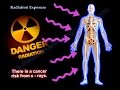 Radiation Exposure and Safety Concerns