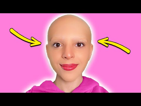 I'm BALD!