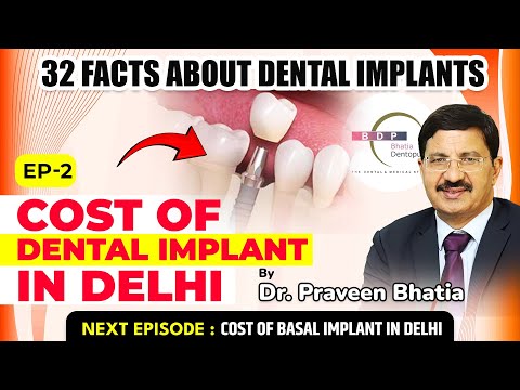 Implant karwane me Kitna Kharcha ata hai? Dr. Praveen Bhatia #implants #newteeth #dentist