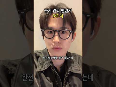 수술 후 붓기관리 3주 차