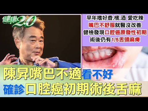 陳昇嘴巴不適看不好 確診口腔癌初期術後舌麻 健康2.0