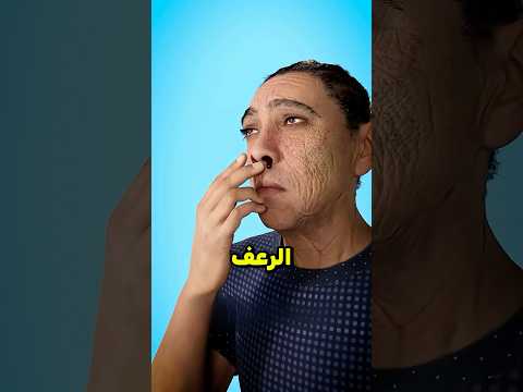 ماذا تفعل في حالة الرعاف😳!!؟