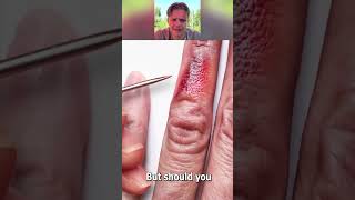 OMG...