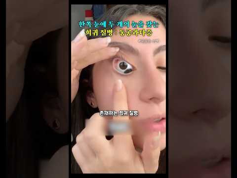 실제 있는 사륜안?