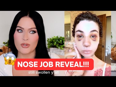 BHAD BHABIE's Nose Job TRUTH Finally Revealed! - REACTION