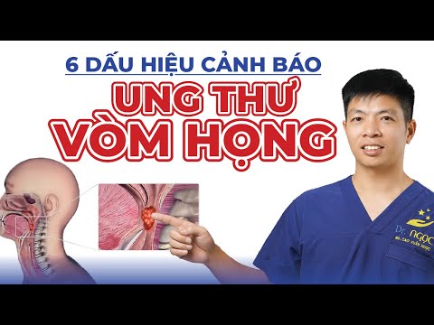 6 Dấu Hiệu Cảnh Báo Tình Trạng Ung Thư Vòm Họng | Dr Ngọc