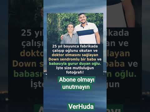 Down Sendromlu Baba