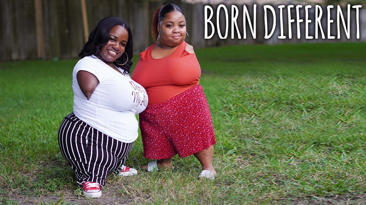 7 extraordinary people living without limbs - born different