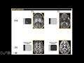 Myelination and White Matter Development