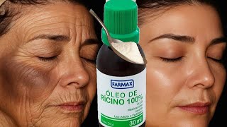 MINHA MÃE AOS 82 ANOS TIRA CODIGO DE BARRA\ RUGAS NA TESTA COM RICINO - usa 3 vezes
