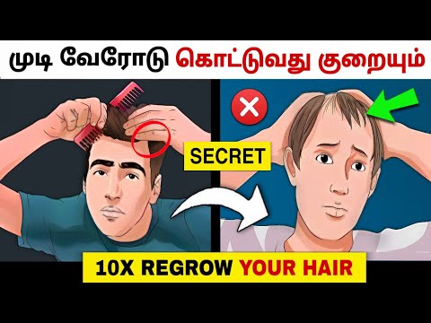 7 WAYS TO STOP HAIRFALL *NATURALLY* Hair Care Routine🔥(Men & Women) தமிழ்