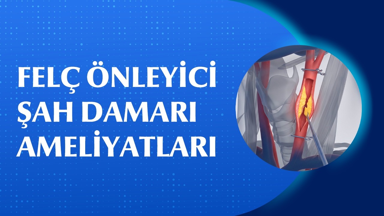 Felç Riskini Azaltan Şah Damarı Ameliyatları Nasıl Yapılır? | Prof. Dr. Faruk Hökenek