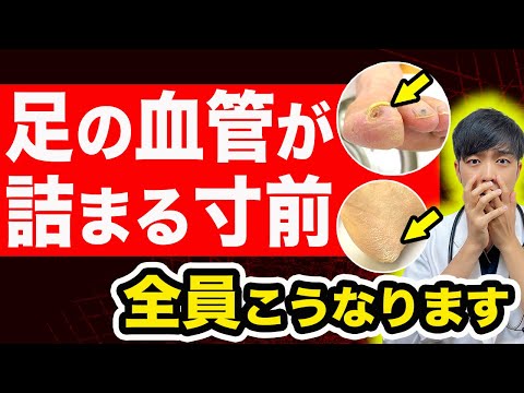 足の血管が詰まる直前に出る４つの危険サイン、必ずこうなります。【なぜ報道しない？】