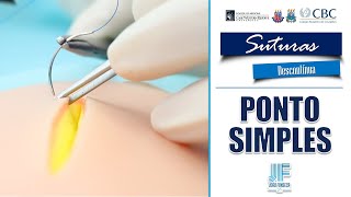 PONTO SIMPLES 🪡🪢 Suturas (Joao Fonseca)