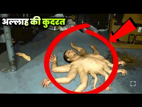 इस दुनिया में ऐसे लोग भी मौजूद हैं | Allah ki qudrat ka karishma