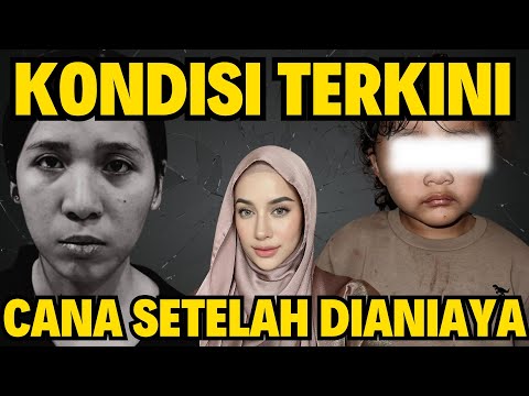 KONDISI CANA SETELAH DIANIAYA!!