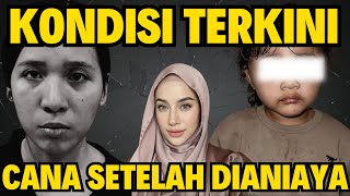 KONDISI CANA SETELAH DIANIAYA!!