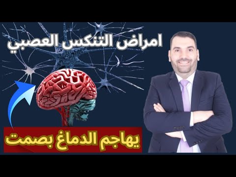 المرض الصامت يفتك بخلايا الجسم وعلاجه بشي بسيط جدا