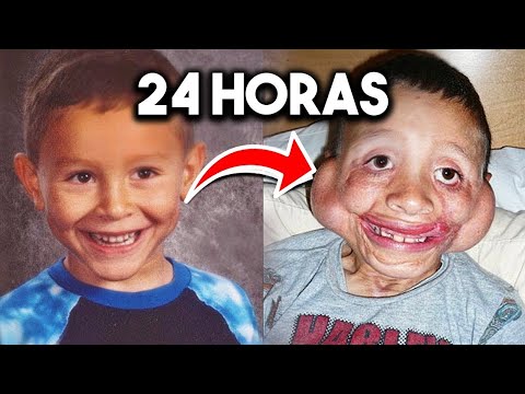 Personas que sobrevivieron lo IMPOSIBLE