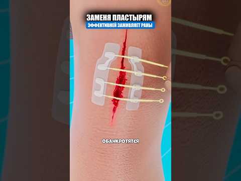 Практичный пластырь для любых порезов