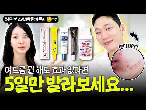여드름균 굳혀주는 3,000원 스팟템…? 처음 본 스팟템 한가득🔥준돌님 여드름+색소침착 인생템 17가지🤓(약국템, 색소침착 연고, 여드름 스팟템, 스킨케어, 클렌징)