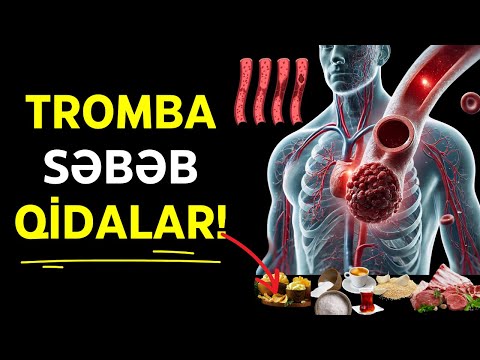 Tromb  yaradan qidalar - Damarları Tıxayır - Uzaq durun