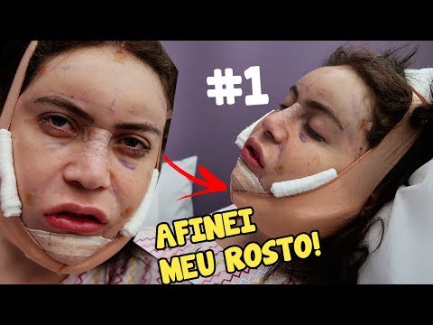MINHA CIRURGIA PLÁSTICA NA COREIA DO SUL #1 - VIREI COREANA!  (V LINE surgery)