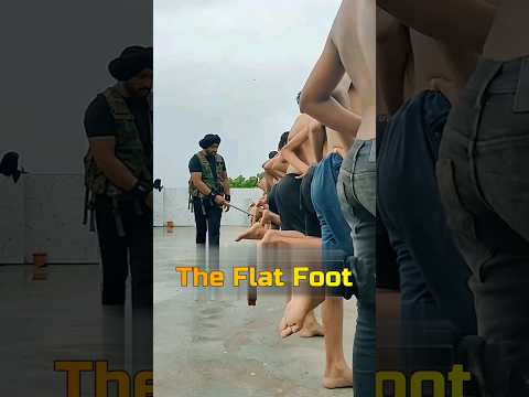 The Flat Feet😱😱#shorts
