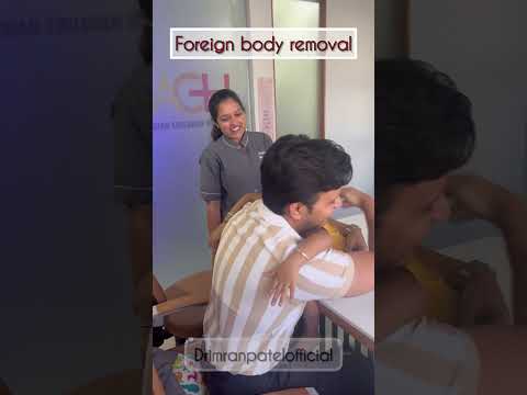 Foreign body removal #drimranpatel #baby #doctor #shortsfeed
