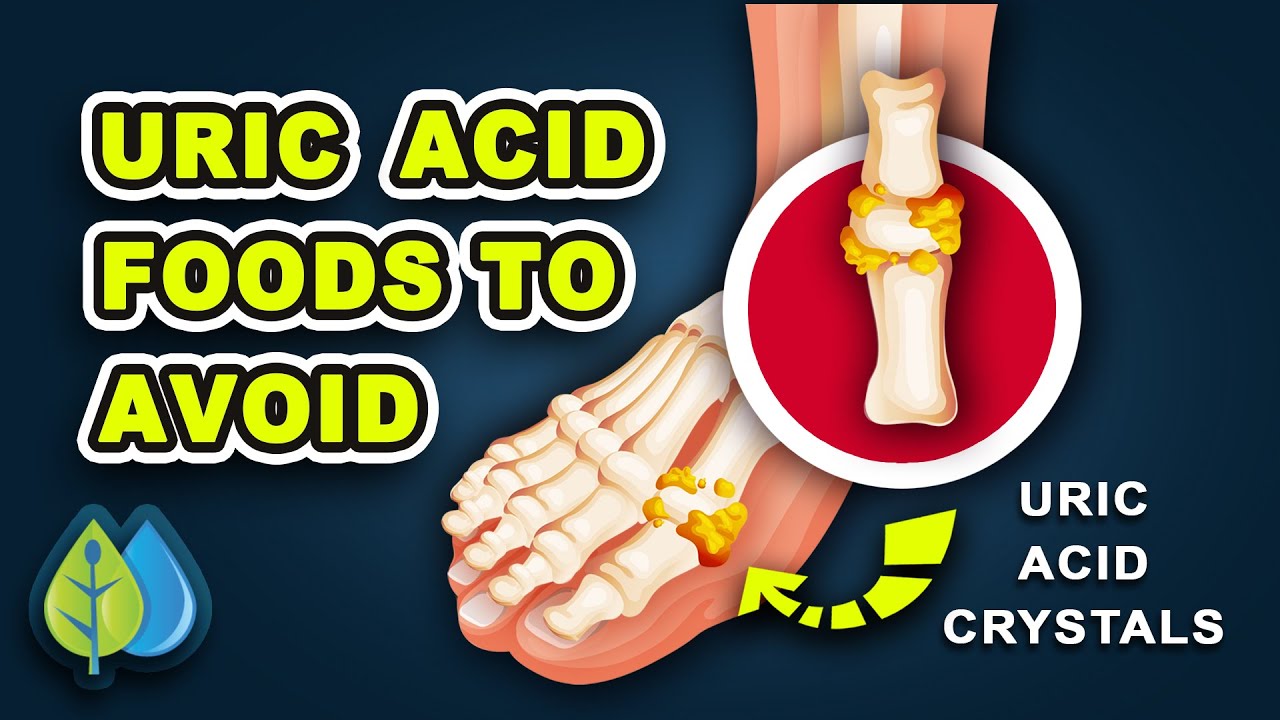 Top 10 Uric Acid Foods to Avoid￼