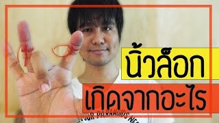 โรคนิ้วล็อกเกิดจากอะไร  เรื่องนี้มีคำอธิบาย