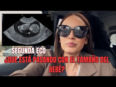 SEGUNDA ECO👶¿QUE ESTÁ PASANDO CON EL TAMAÑO DEL BEBÉ?🚼
