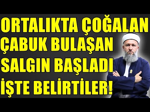 YENİ SALGIN! BU BELİRTİLER VARSA HEMEN DOKTORA GÖZÜKÜN! Hüseyin ÇEVİK