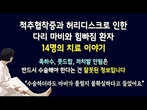 디스크와 협착증으로 인한 다리 마비와 힘빠짐을 비수술로 회복시키는 근육신경재활치료