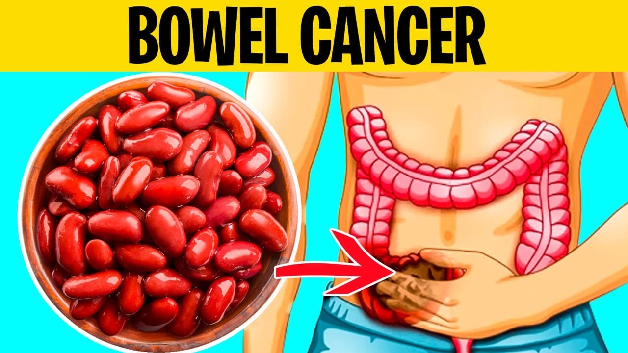 7 SUPERFOODS to Reduce Your Risk of BOWEL CANCER