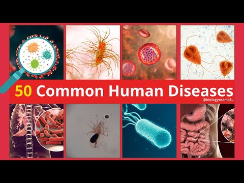 50 Common Human Diseases, Causative Organism, Site of Infection