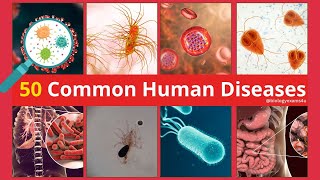 50 Common Human Diseases, Causative Organism, Site of Infection