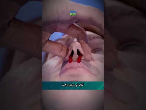 ุฅูู ุงูุตุญ ุชุนู
ููู ูู ุฃููู ูุฒูุชุ